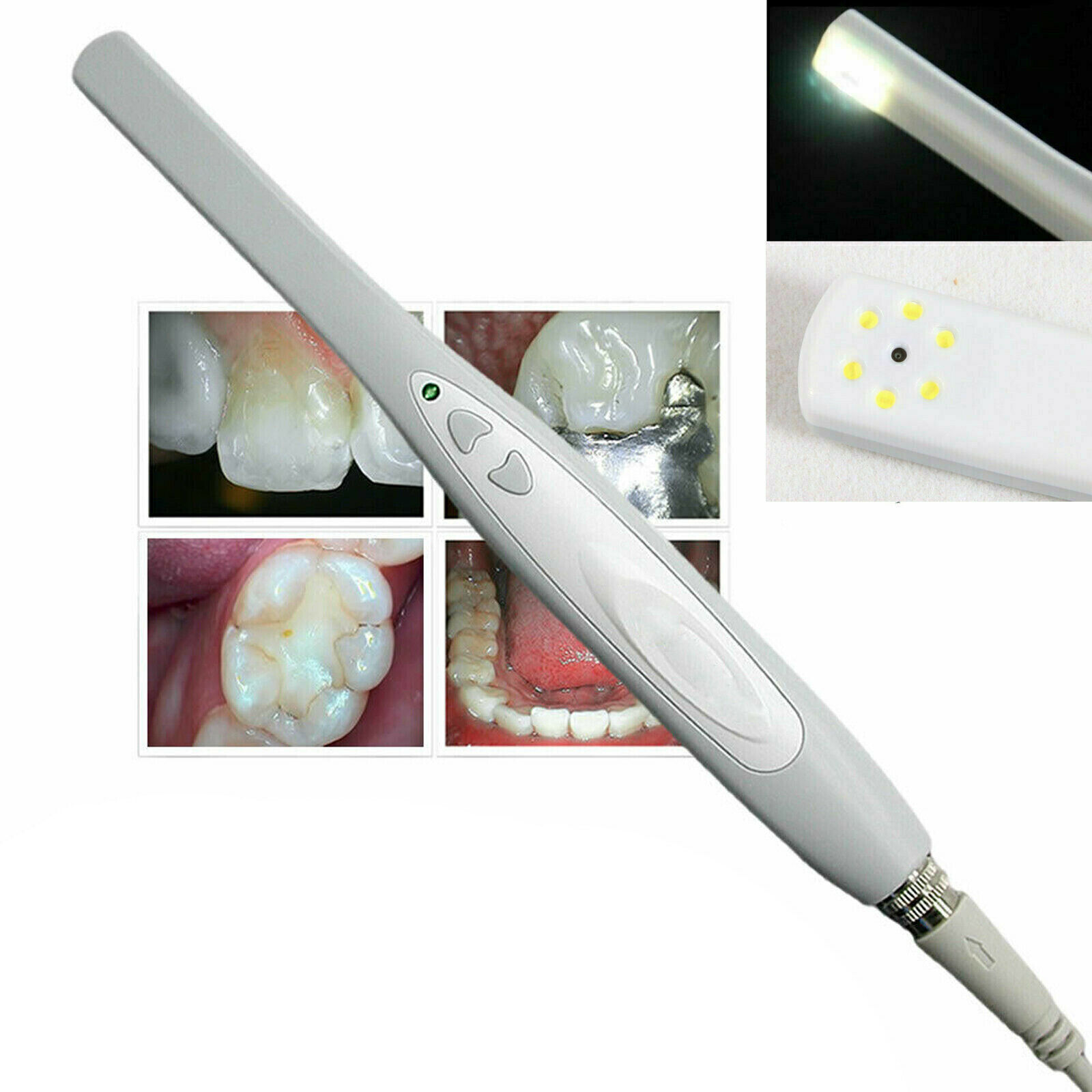 Intraoral Intra Oral Dental Camera IMAGE IMAGING SYSTEM 1/4″ Sony USB 2.0 MD740