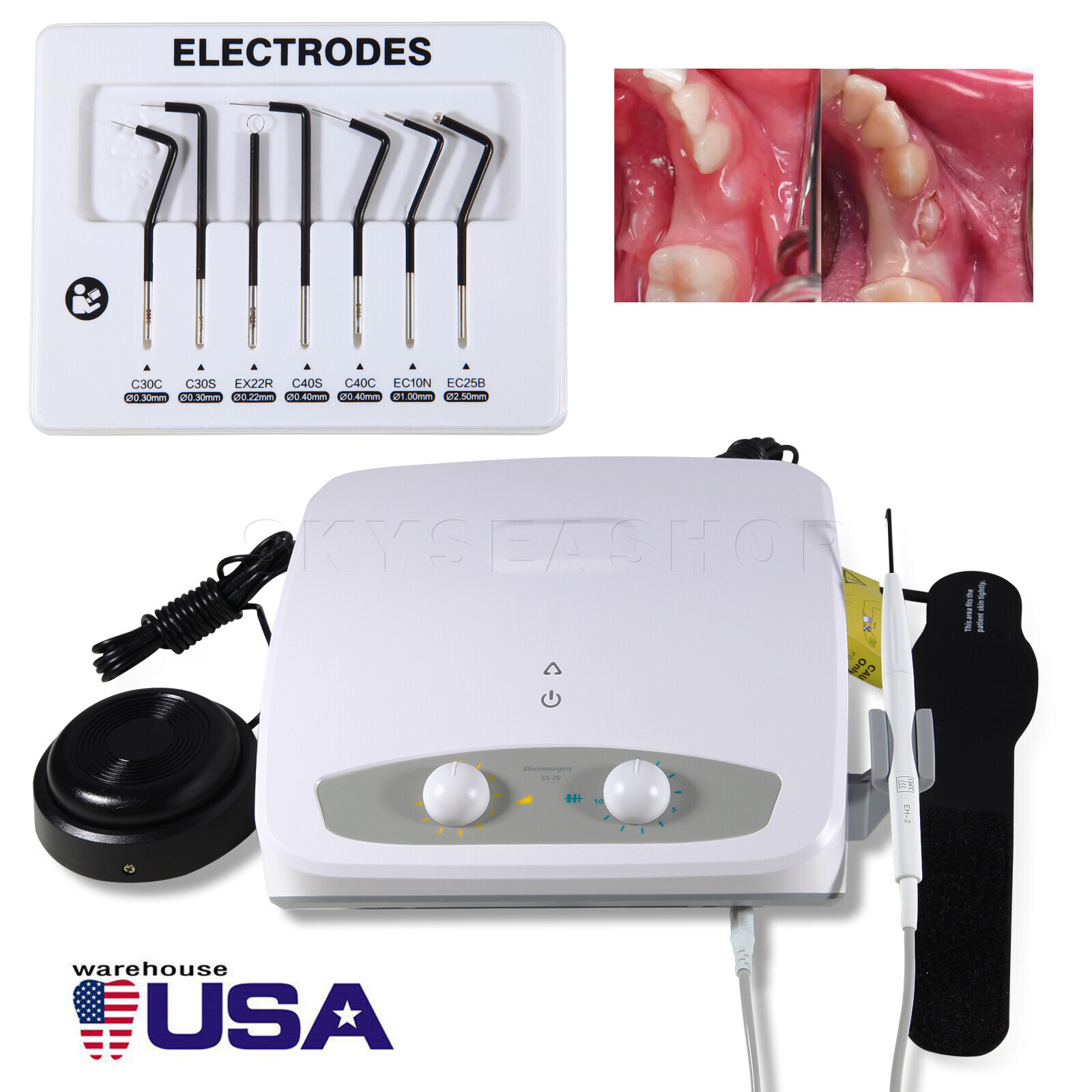 Electrosurge 110V dental electrosurgery unit Dental