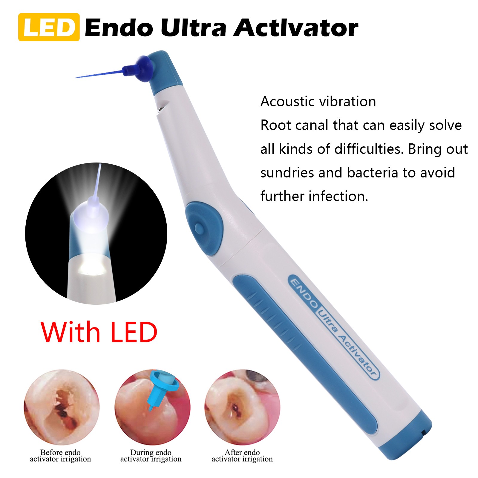 Dental LED Endo Ultrasonic Sonic Activator Root Canal Irrigator + 150Tips Free