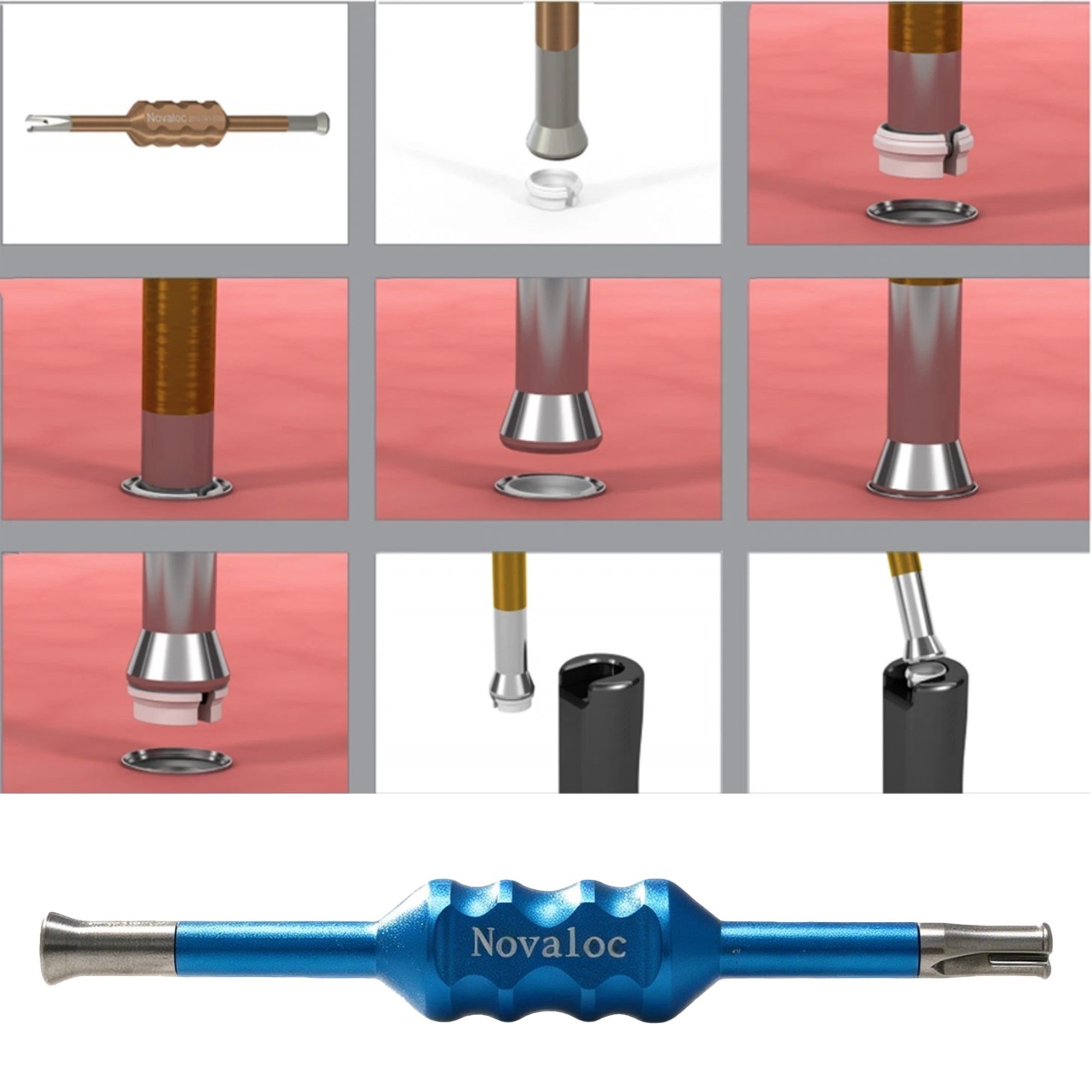 US Dental Novaloc Retention Inserts Caps Peek Locator Mounting & Demounting Tool