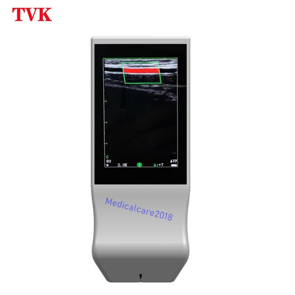 Portable Wireless WiFi Color Doppler linear Ultrasound Scanner, 128 Elements