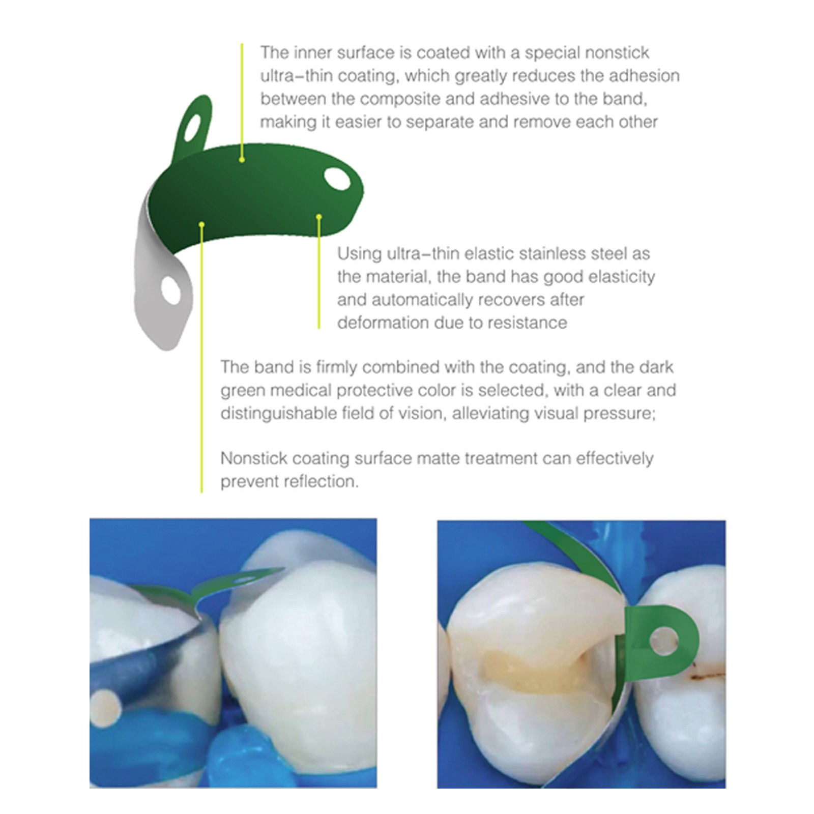 Dental Non-stick Matrix Bands Palodent 3D Fusion Firm Sectional Matrices M4 2.0