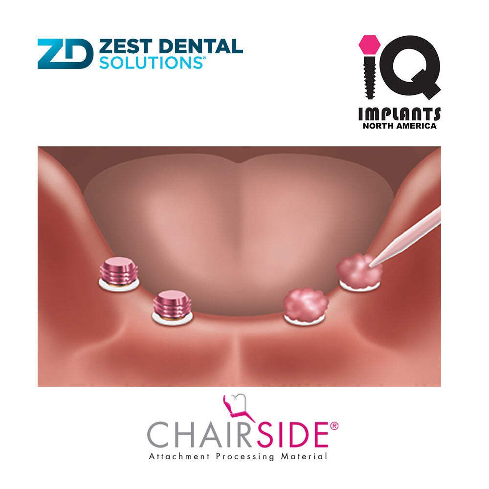 Zest CHAIRSIDE Genuine Attachment Processing Material, Fast Set 18ml