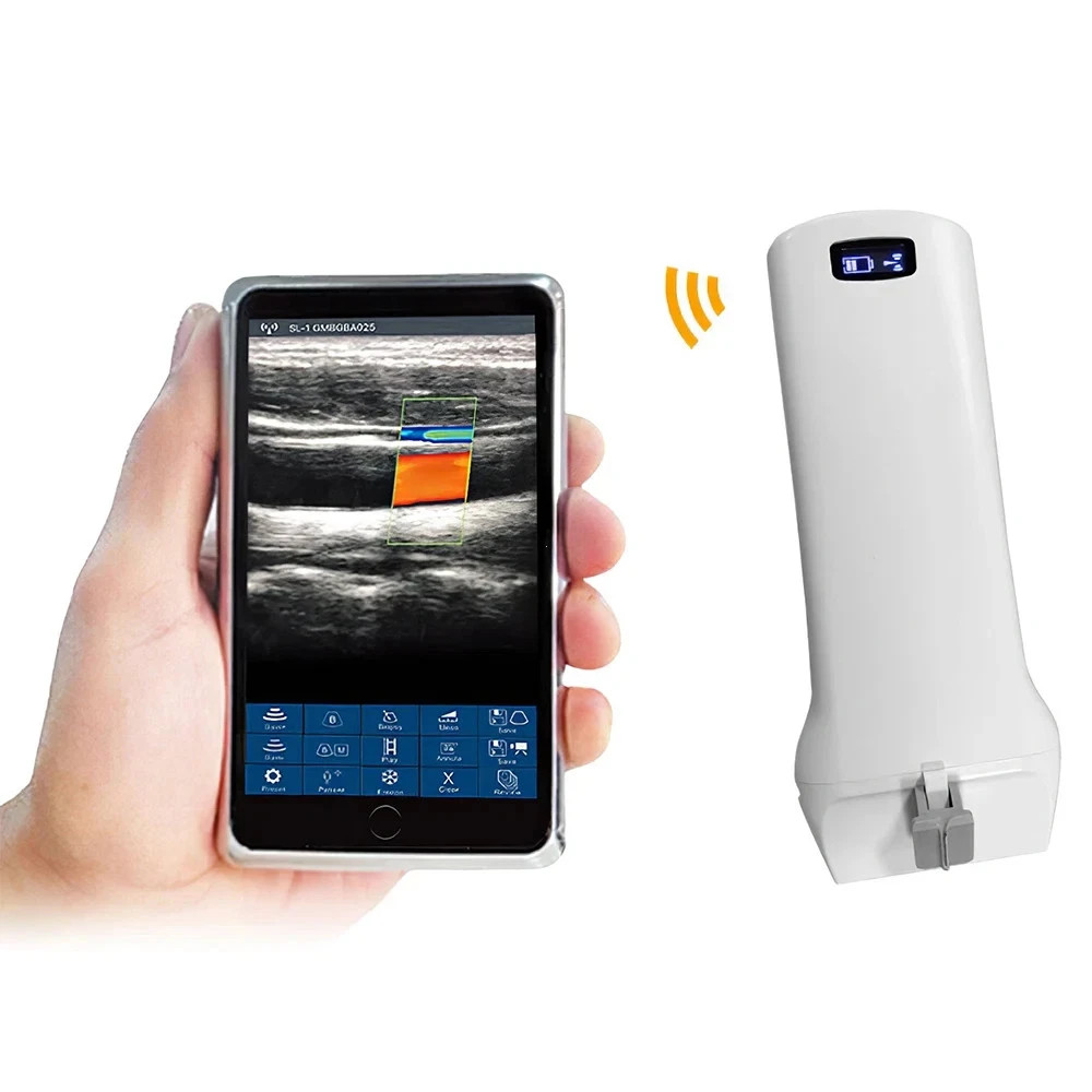 192E Wireless Linear Color Doppler Ultrasound Probe – for Breast, Hip, MSK