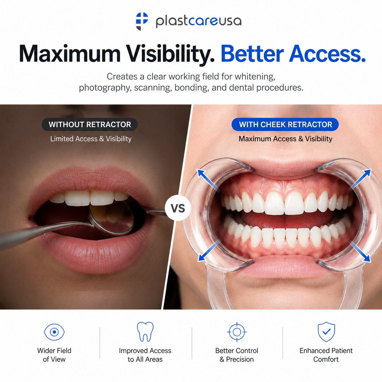 20 x Medium Teeth Whitening Cheek Retractor, Dental Mouth Opener Game MED