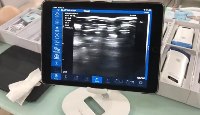 128 Elements 3 in 1 Wireless Color Doppler Wifi Ultrasound Probe Convex Linear