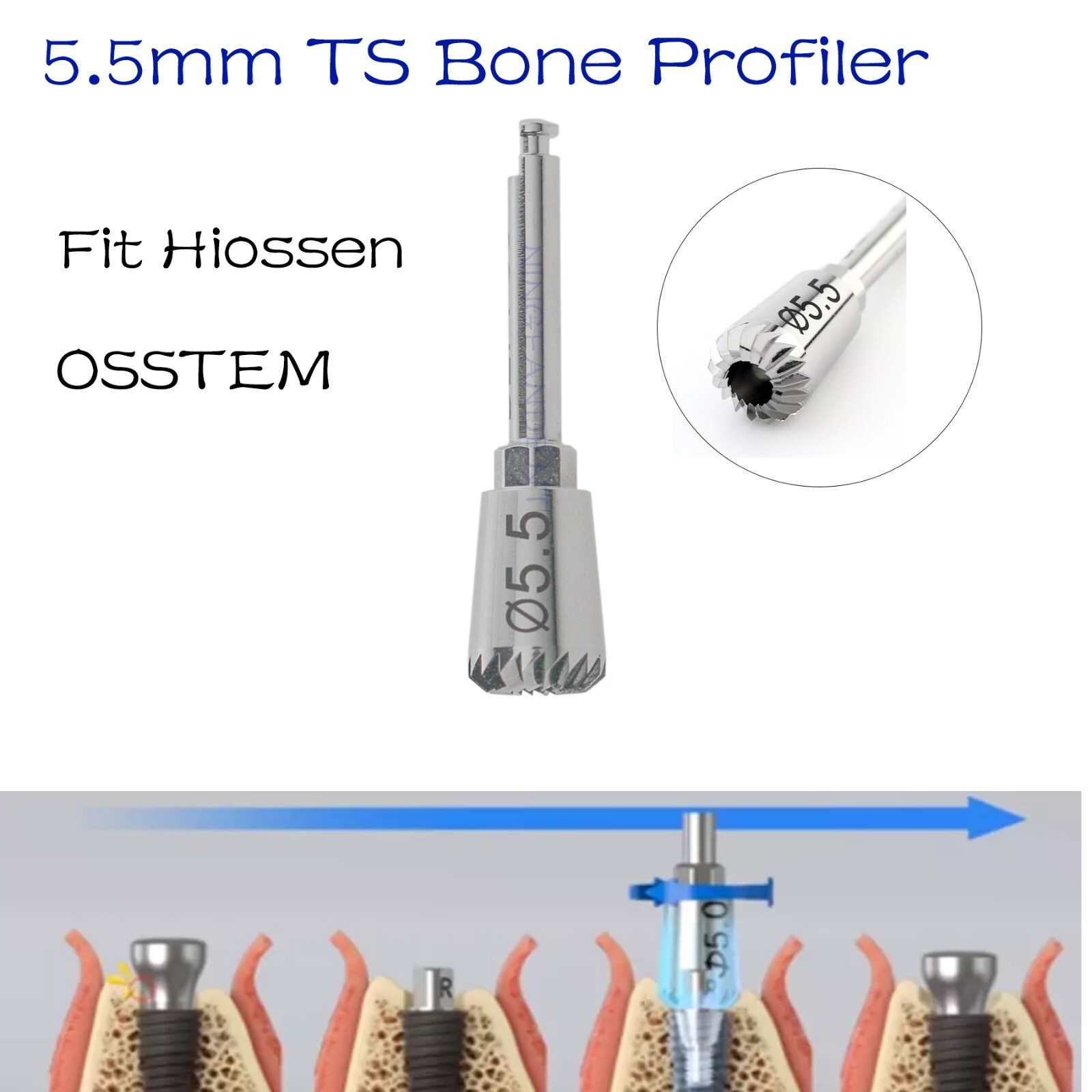 Implant Bone Profiler Screw Drivers Osstem Dental Torque Wrench Tool For Hiossen