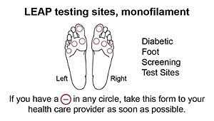 Baseline Disposable Monofilaments – ADA and LEAP Programs
