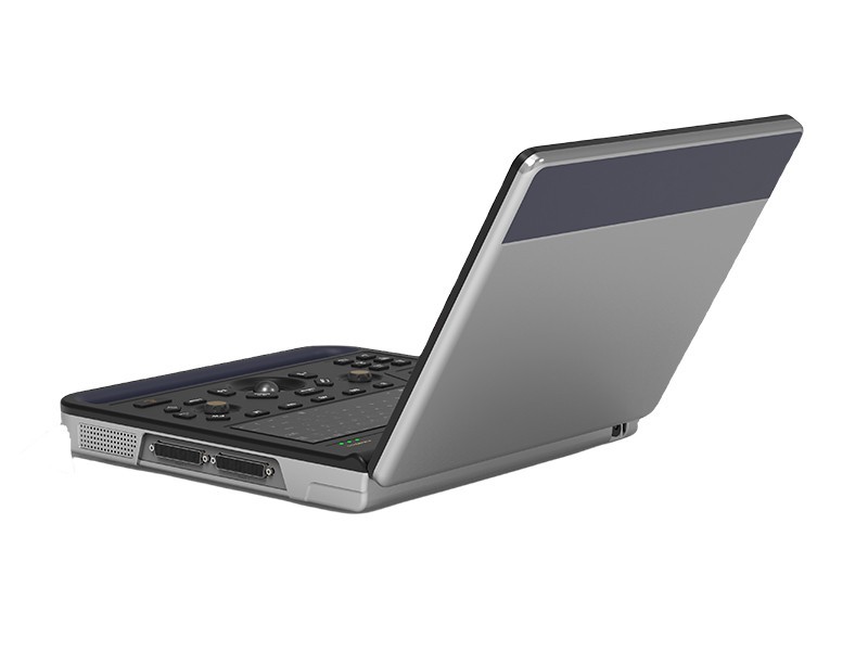 All-Digital Portable Laptop Ultrasound Diagnostic System for Clinic Doctor