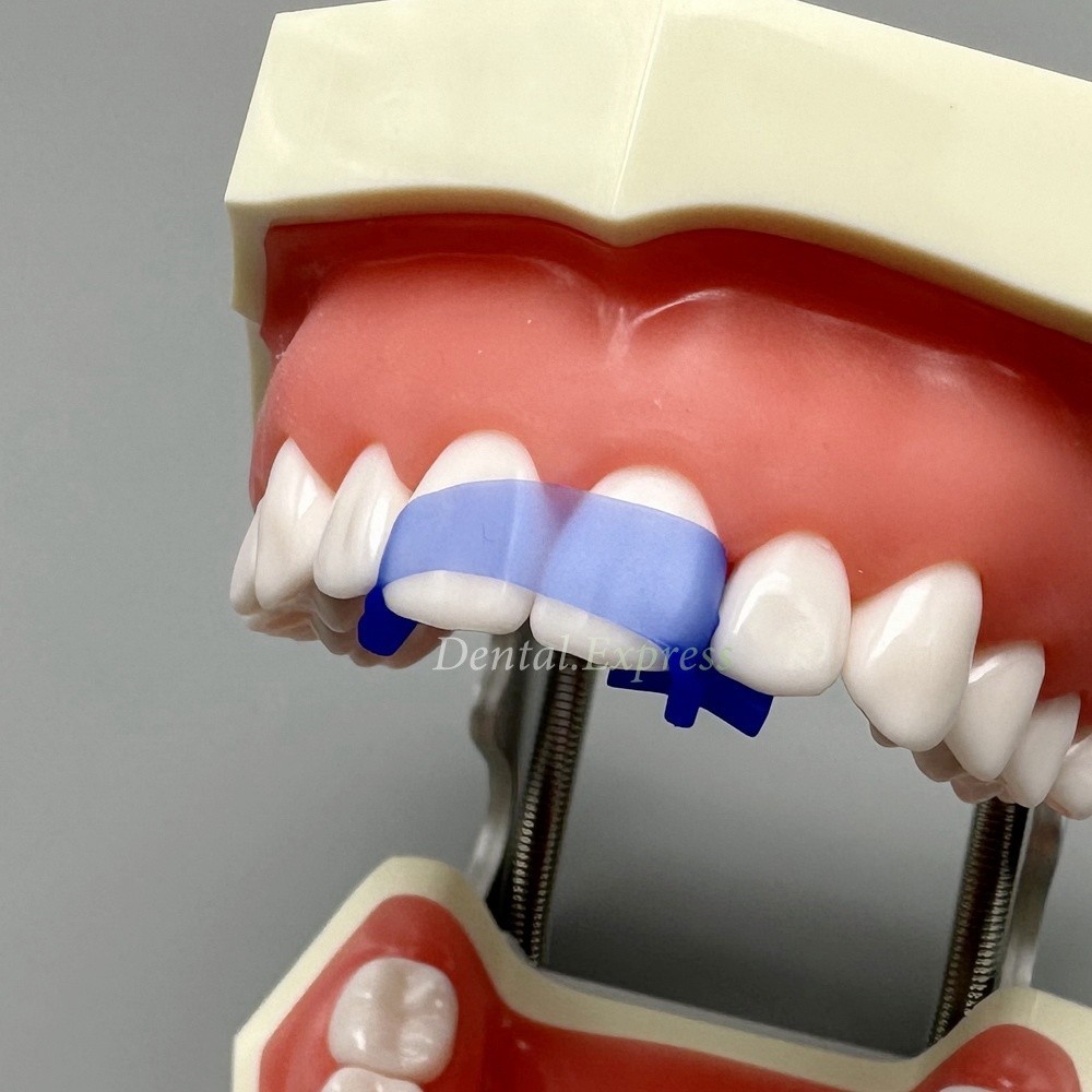 Dental Elastic Wedges Protector Anterior Front Teeth Isolating Matrices Strip