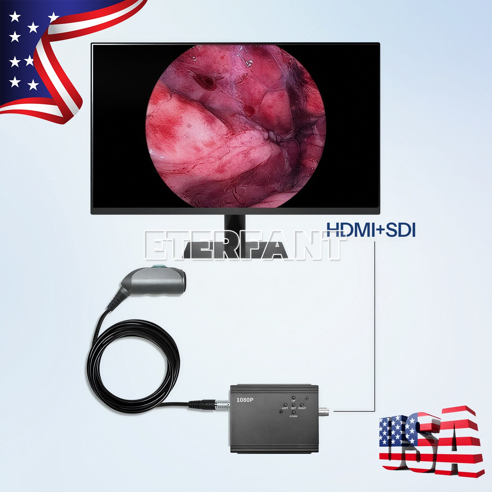 1080p HDMI Full HD ENT Endoscopy Laparoscopic Camera For Medical Endoscope US