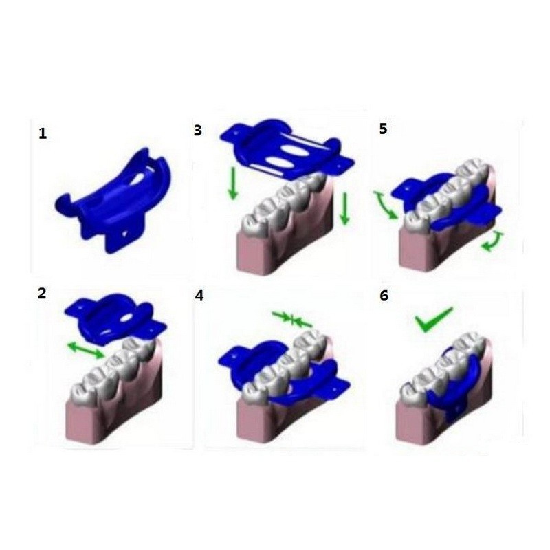 20pcs Dental Mini Dam MiniDam Rubber Dam Clamp Holder Dental Silicone Rubber Dam
