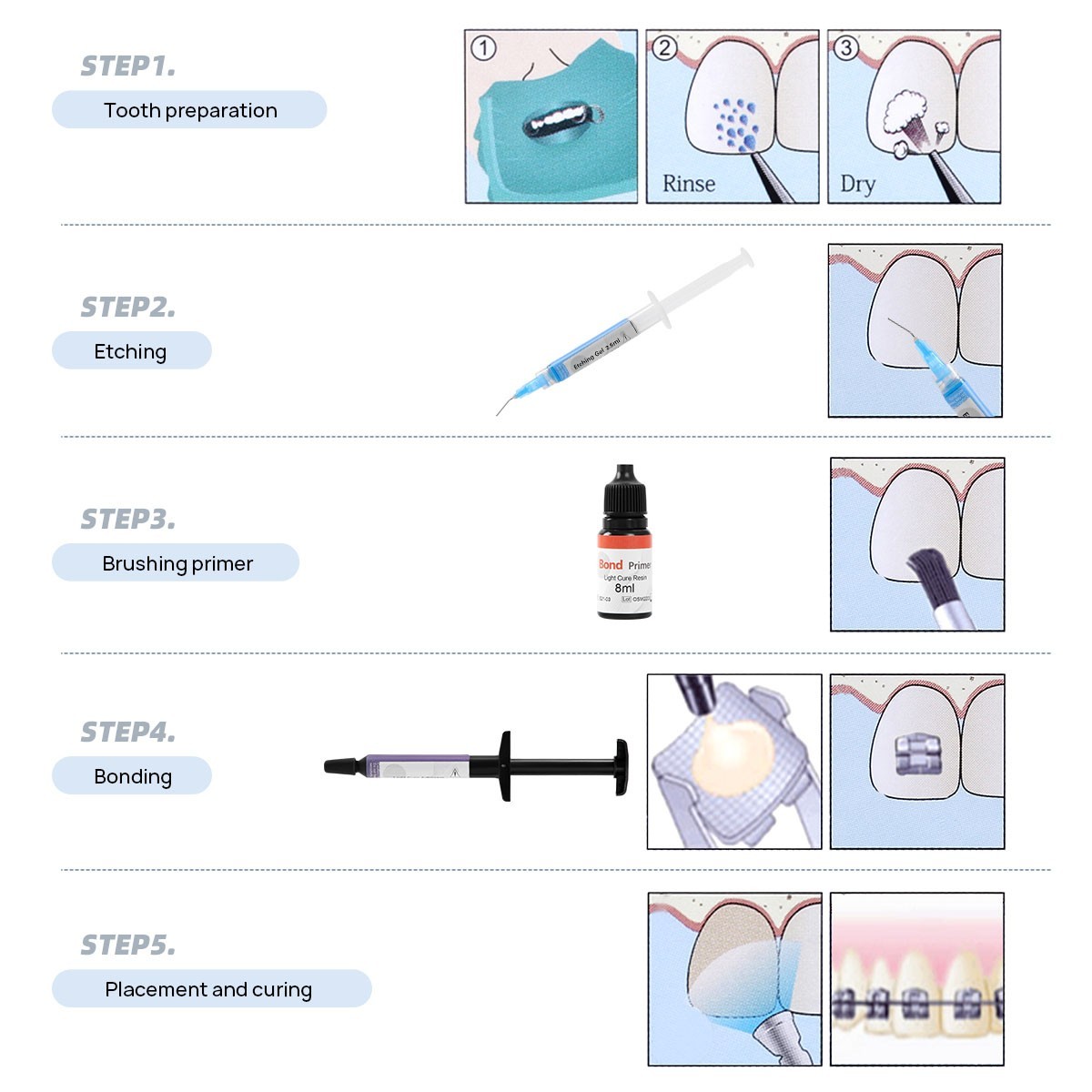 Resina Adhesiva de Curado Dental Ligera Primer de Jeringa Soporte de Ortodoncia
