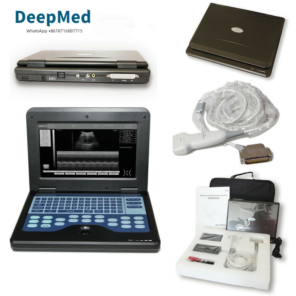 Portable Ultrasound Scanner Laptop Machine Diagnostic System 7.5Mhz Linear Probe