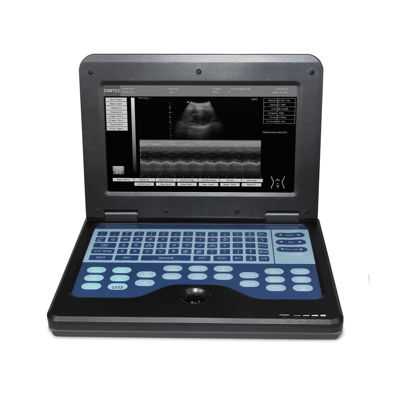 Portable Ultrasound Scanner Laptop Machine Diagnostic System 3.5Mhz Convex Probe