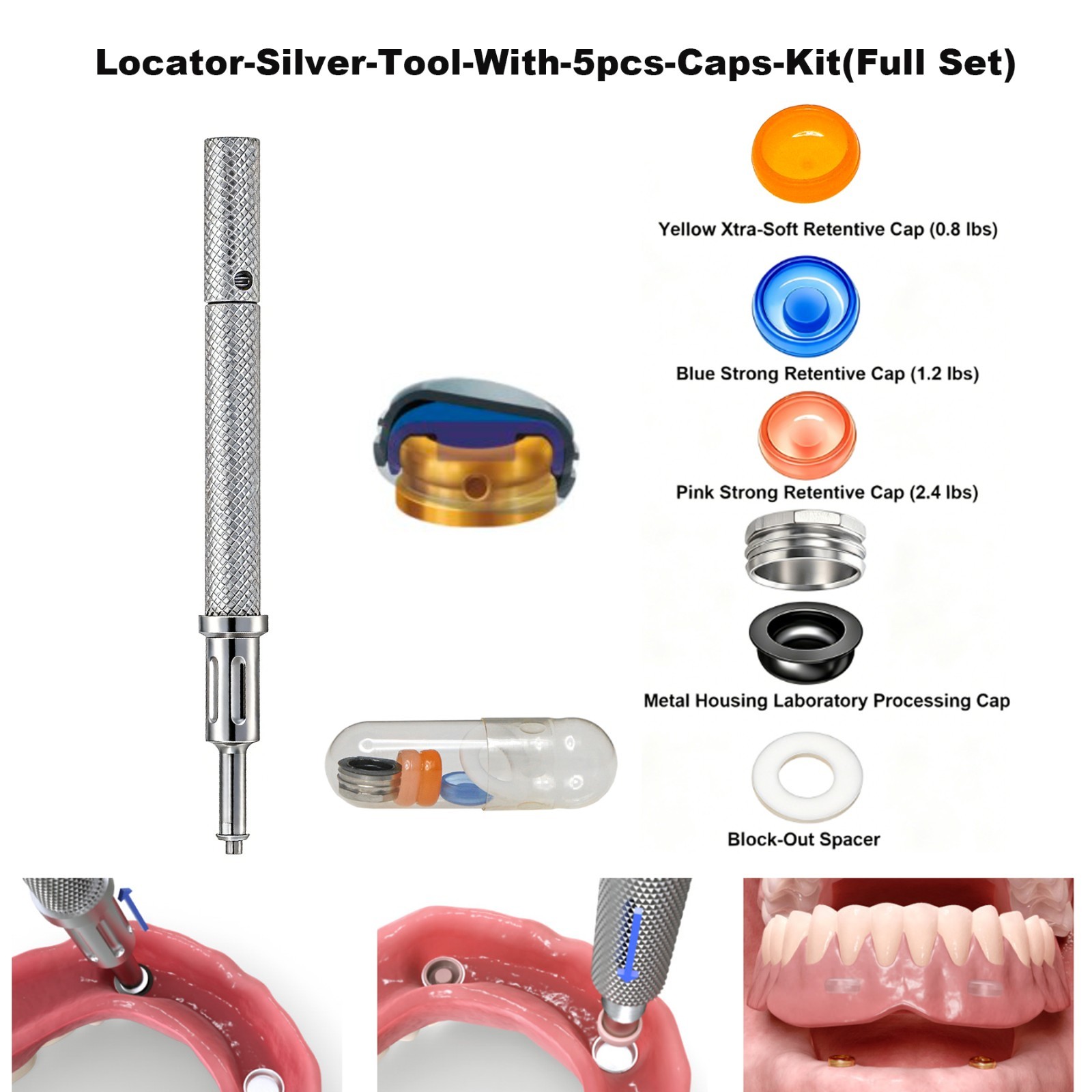 US Dental ZEST Locator Male Caps Kit Overdenture Replacement Inserts Core Tool