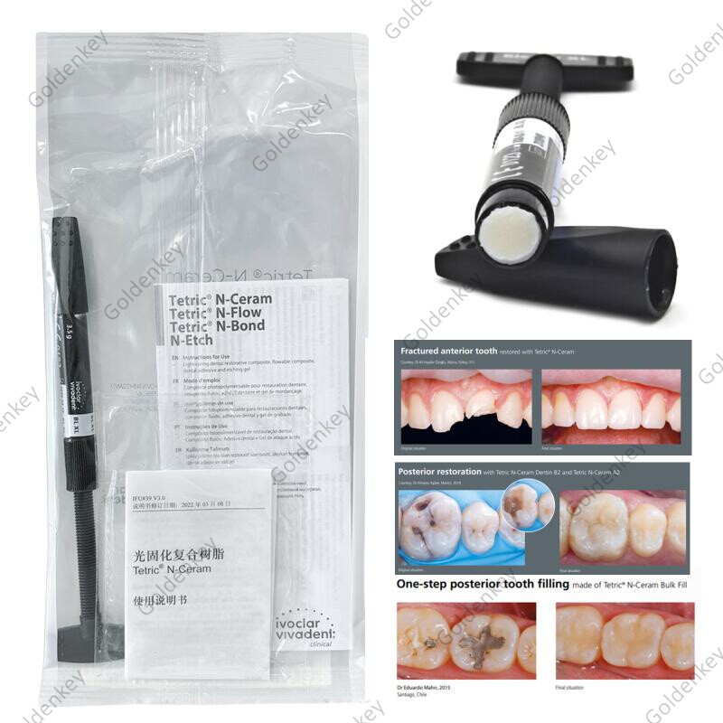 BLXL Dental Tetric N-Ceram Composite Resin BL XL Bleach Color Whitening Veneer