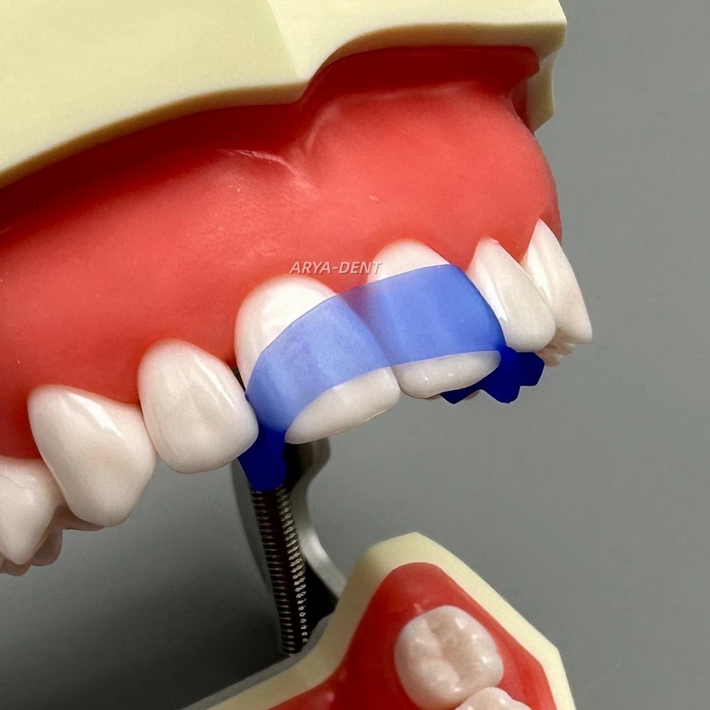 Dental Anterior Elastic Wedges Front Anterior Teeth Matrices Wedge Autoclavable