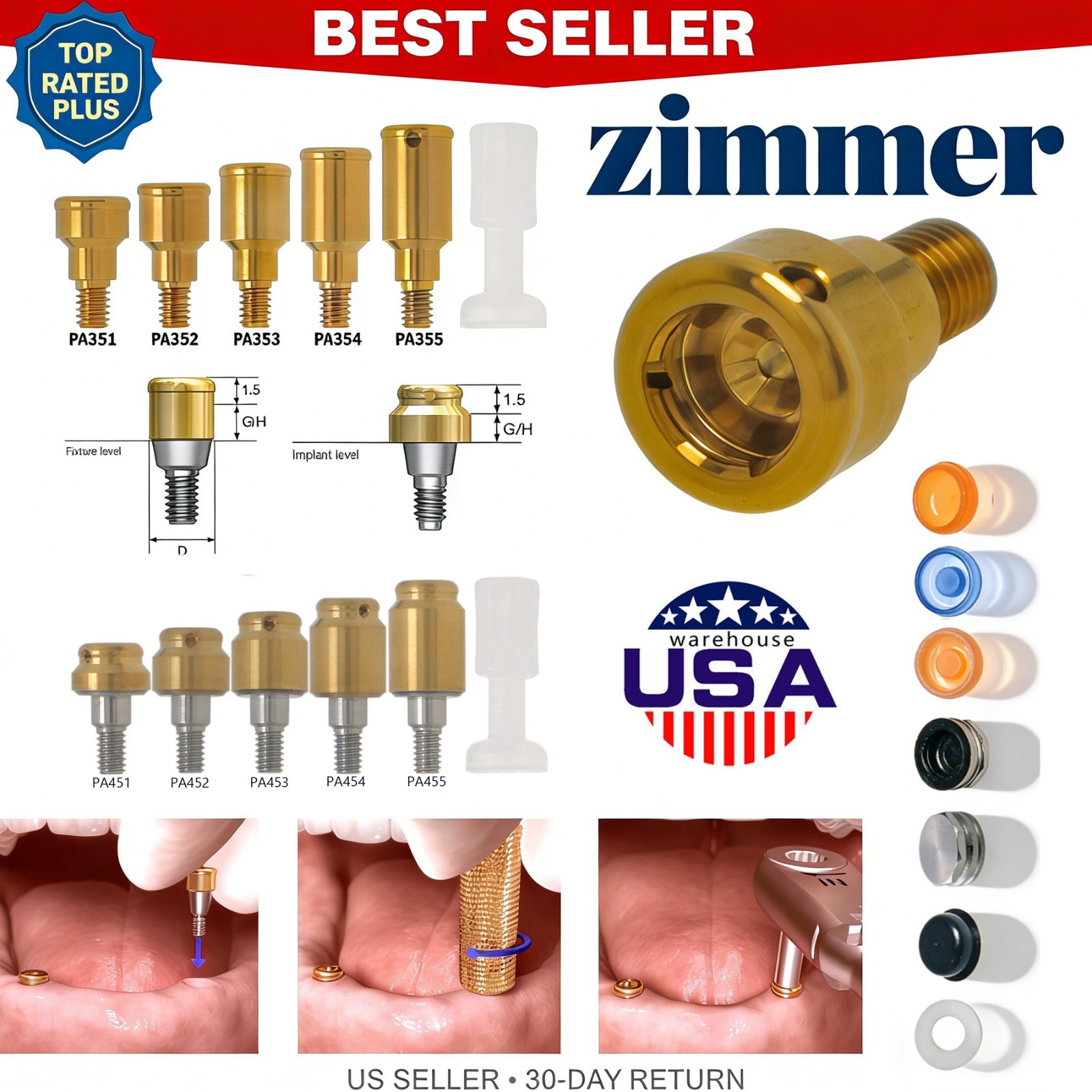 Dental Fit Zest Locator Abutment Legacy Anchor Overdenture Hiossen Zimmer Nobel