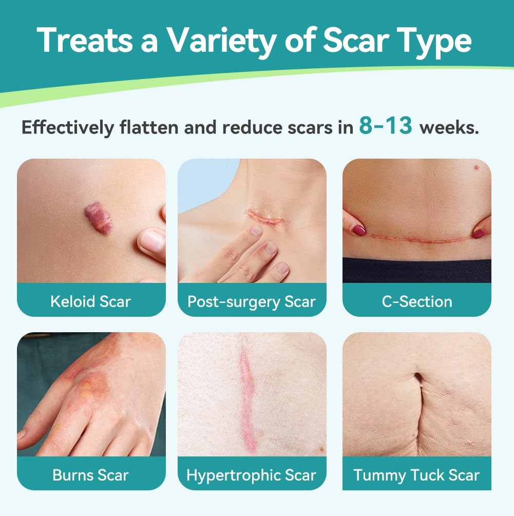 Dimora Medical Grade Silicone Scar Sheets -Ultra Soft Silicone Scar Tape 1.6X60