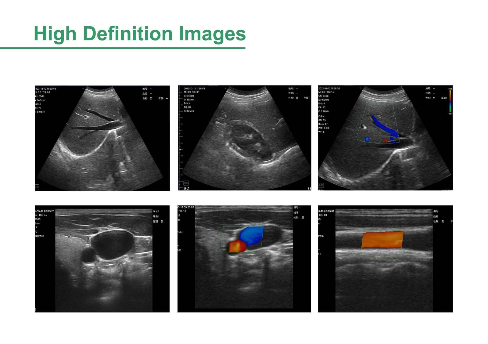 Ultrasound Scanner 5 Interchangeable Probes Convex Linear Phased Array