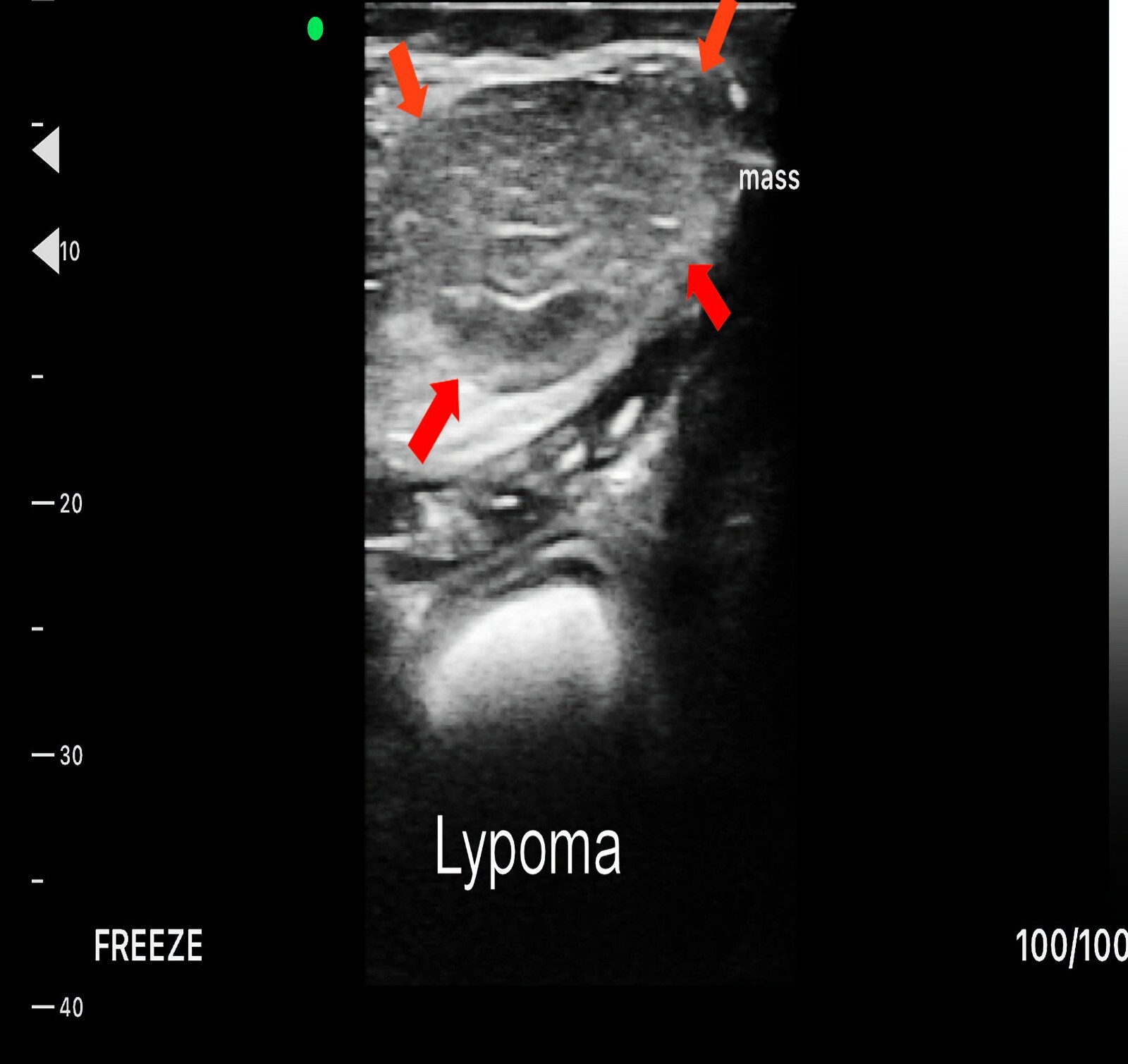 Wifi Wireless Pocket Ultrasound BUY USA, Cardiac Linear Convex Color Doppler