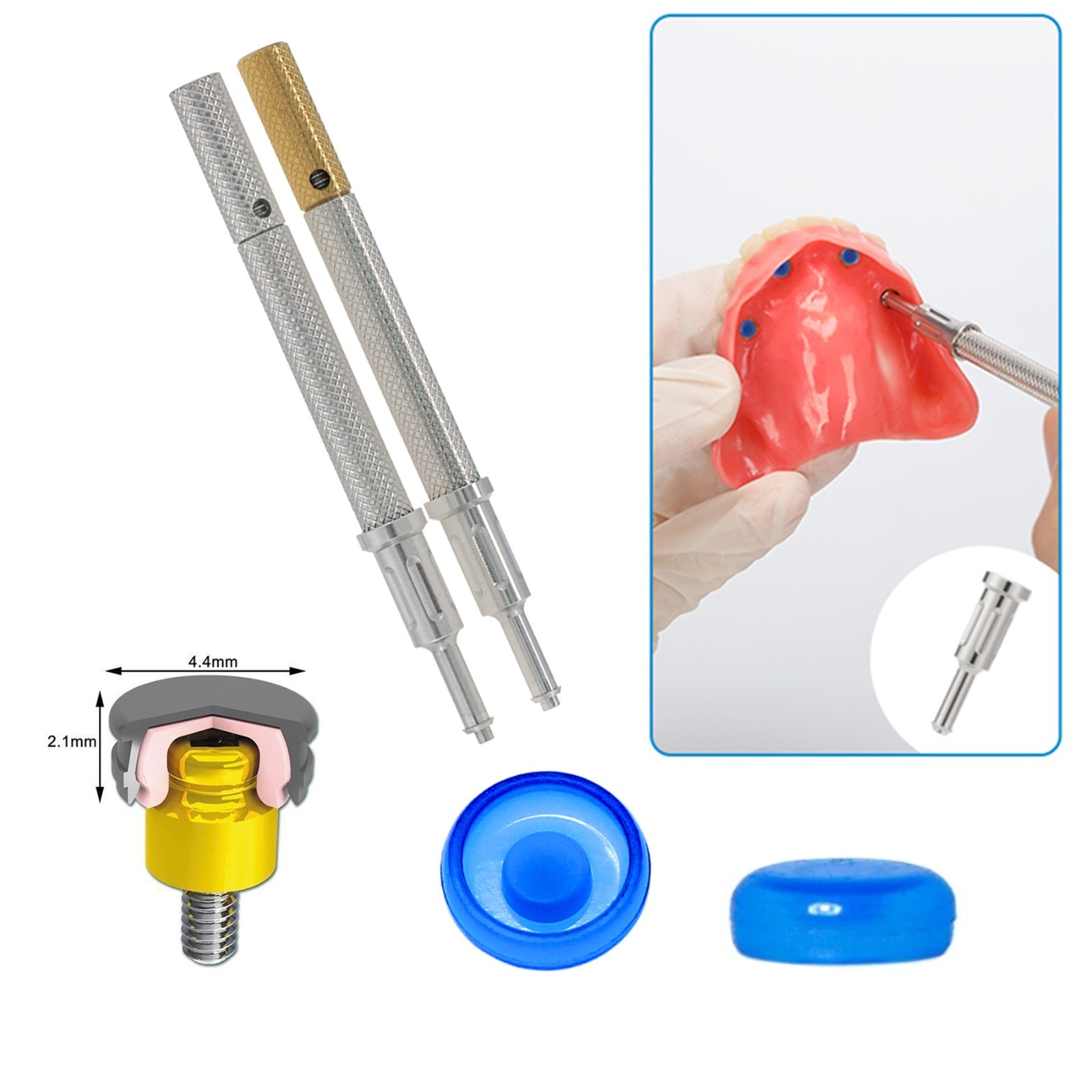 US Overdenture Removable Male Caps Inserts Standard 1.2lbs & LOCATOR Core Tool