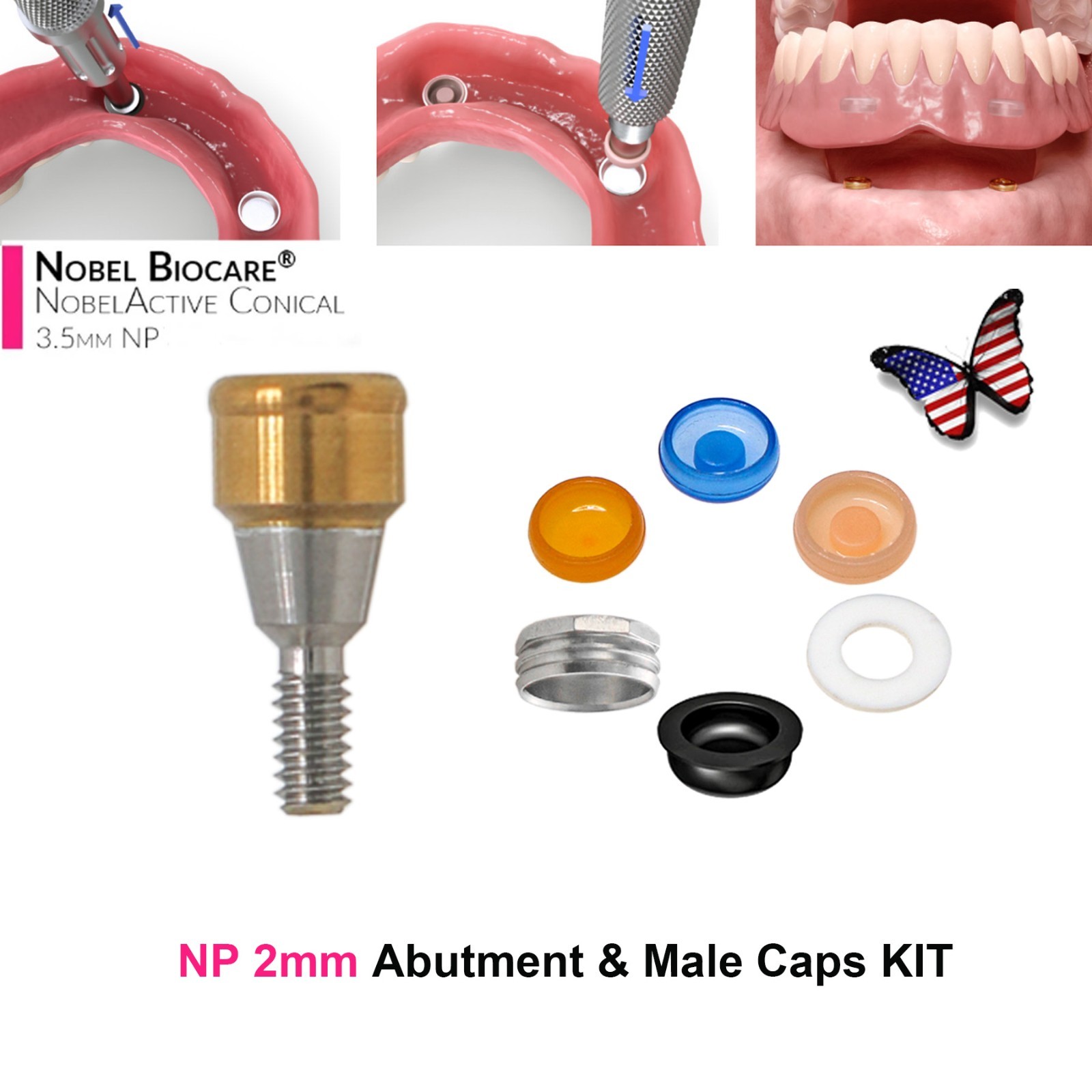 Dental Fit Zest Locator Abutment Legacy Anchor Overdenture Hiossen Zimmer Nobel