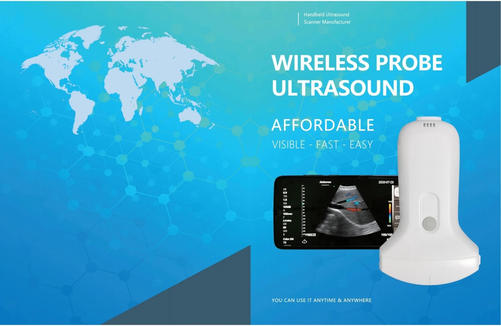 color doppler linear/convex 128 Elements Wireless Ultrasound Probe