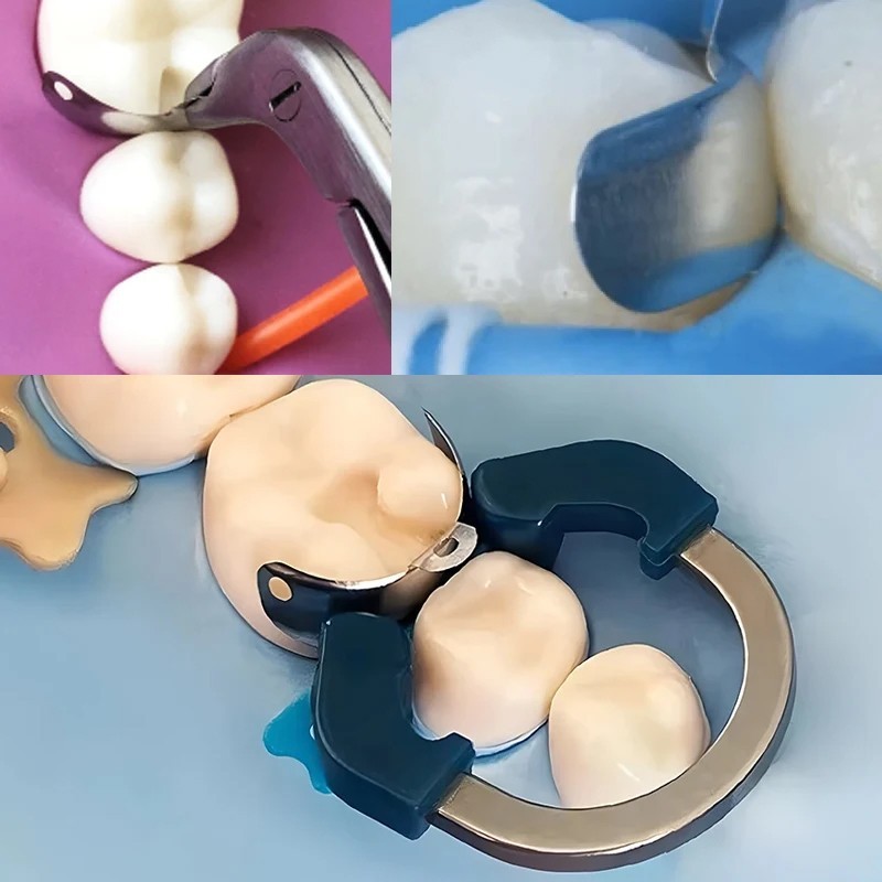 Dental Matrix Bands Ring Sectional Matrice Clamp Wedge C3 Fit Palodent V3 System