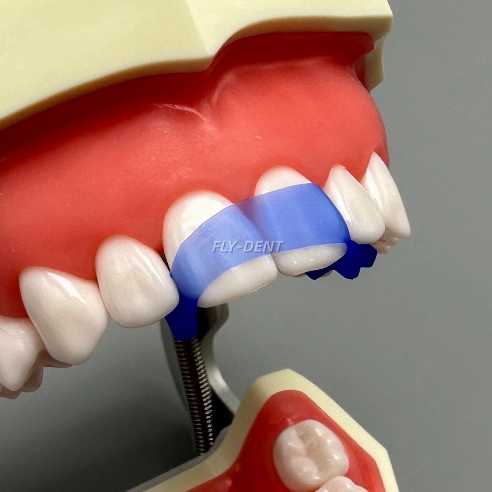 Dental Contoured Anterior Elastic Wedges For Front Anterior Teeth Strip Whiting