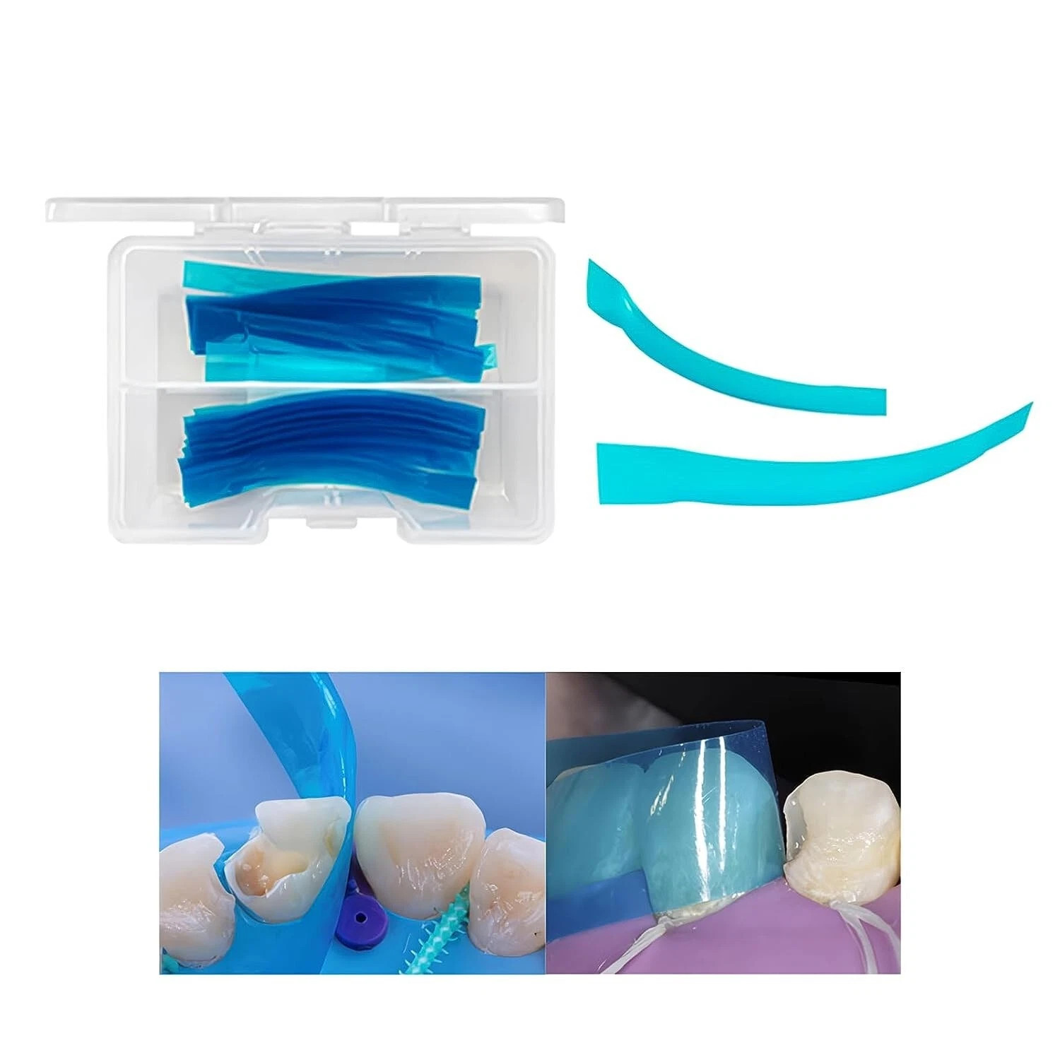 Dental Anterior Restoration Matrix Strip Contoured Resin Repair Matrices 0.05mm