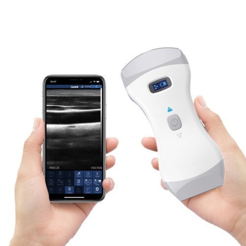 Wireless Ultrasound Scanner Handheld Color Doppler Machine Dual Probe 3 in 1 App