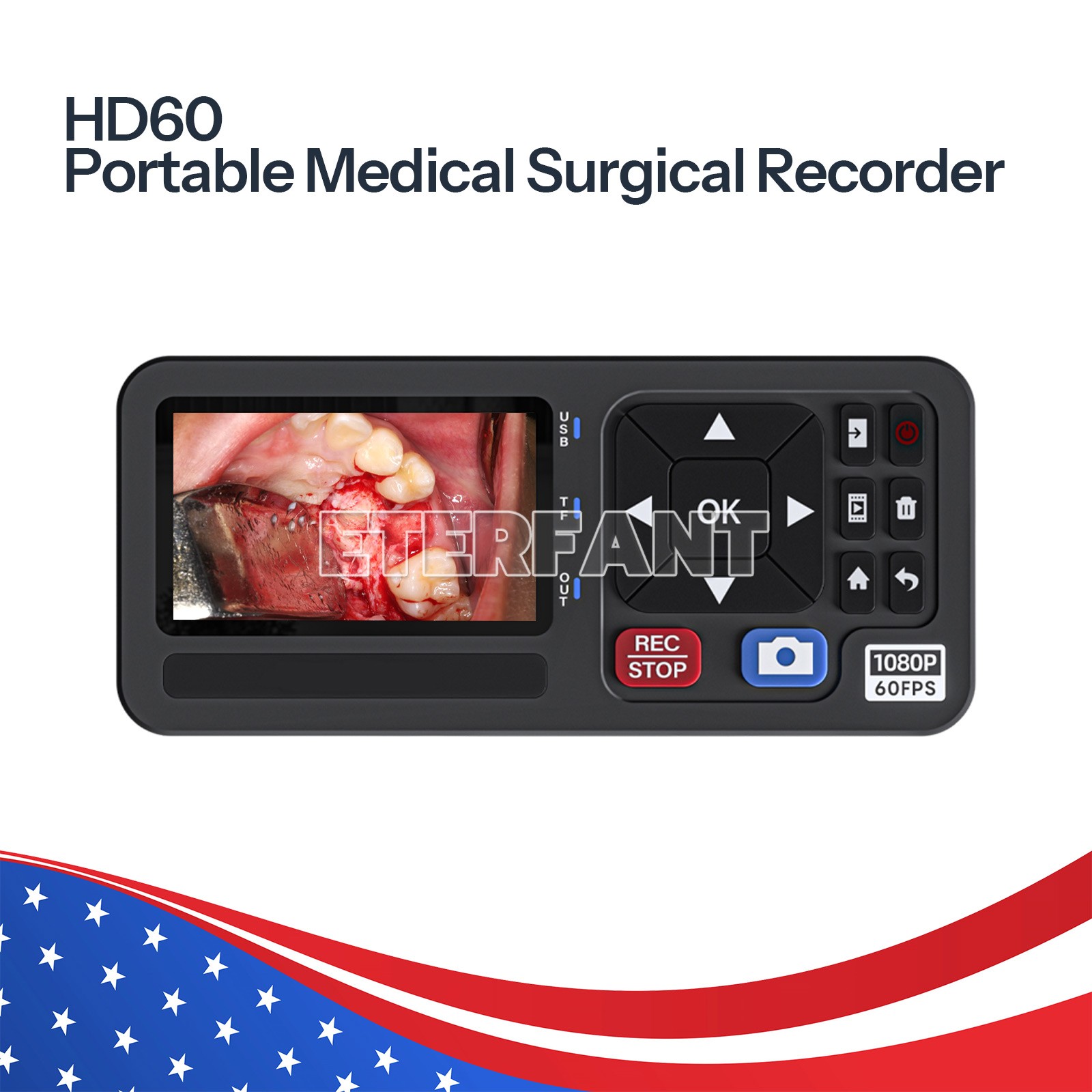 Medical Endoscope 1080p Full HD ENT Camera System/Laparoscopy&Endoscopy Recorder