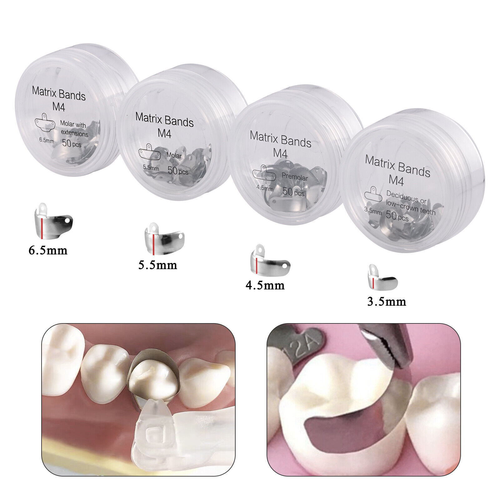 Dental Sectional Matrix Bands Non-Stick Matrice Clamp Ring Fit Garrison Palodent