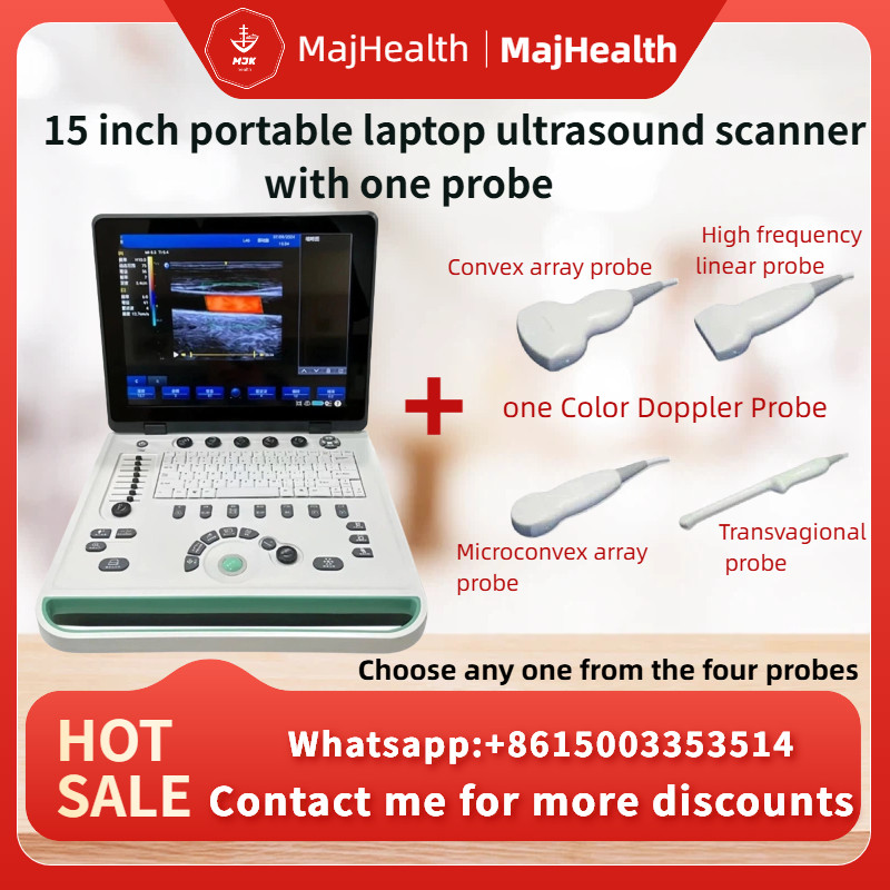 15 inch portable laptop ultrasound scanner with one probes