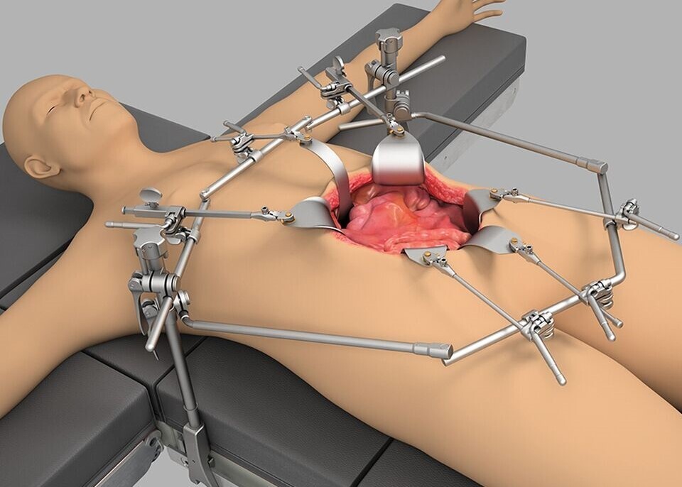 Thompson Retractor Abdominal Surgery Liver Transplant System 30 PCS | NIMZAH