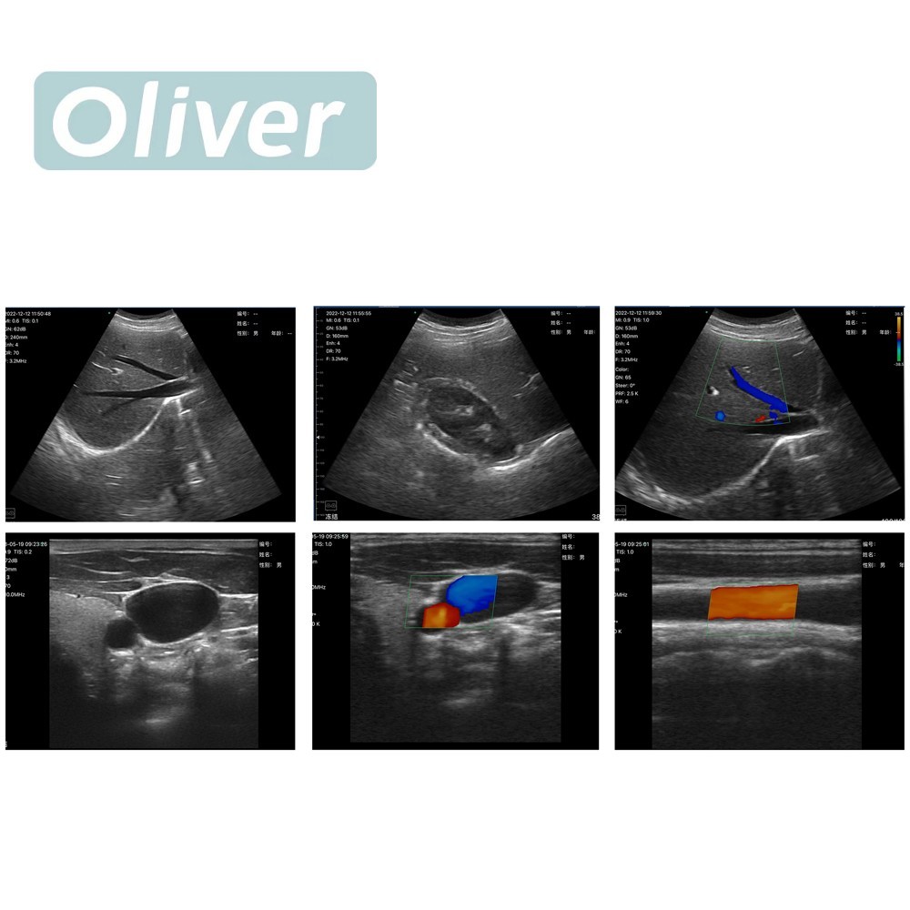 256E 3 in 1 Wifi Wireless Color Ultrasound Doppler Scanner