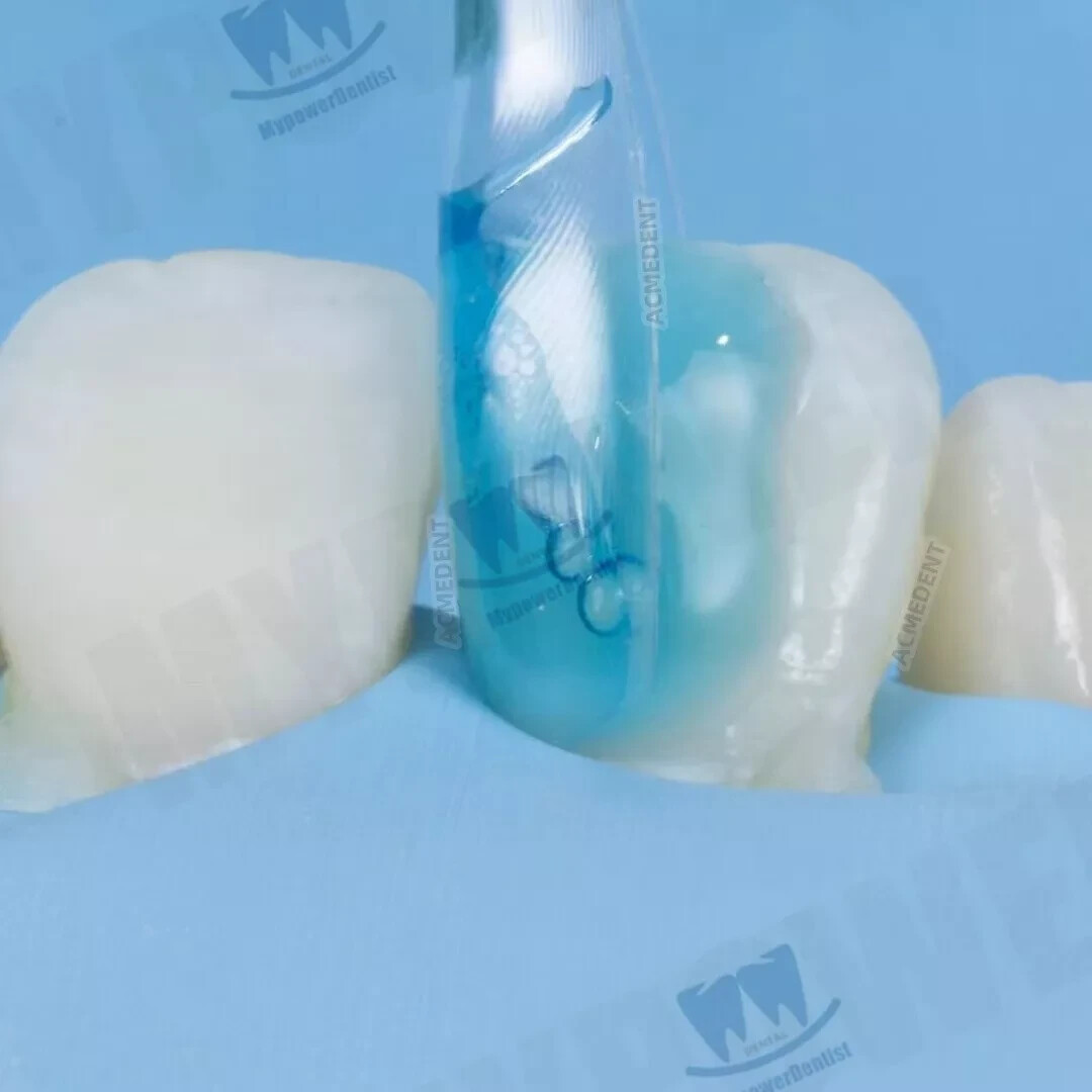 Clear Matrix Dental Diastema Matrices Wedge Similar with Bio Clear Matrice TORVM