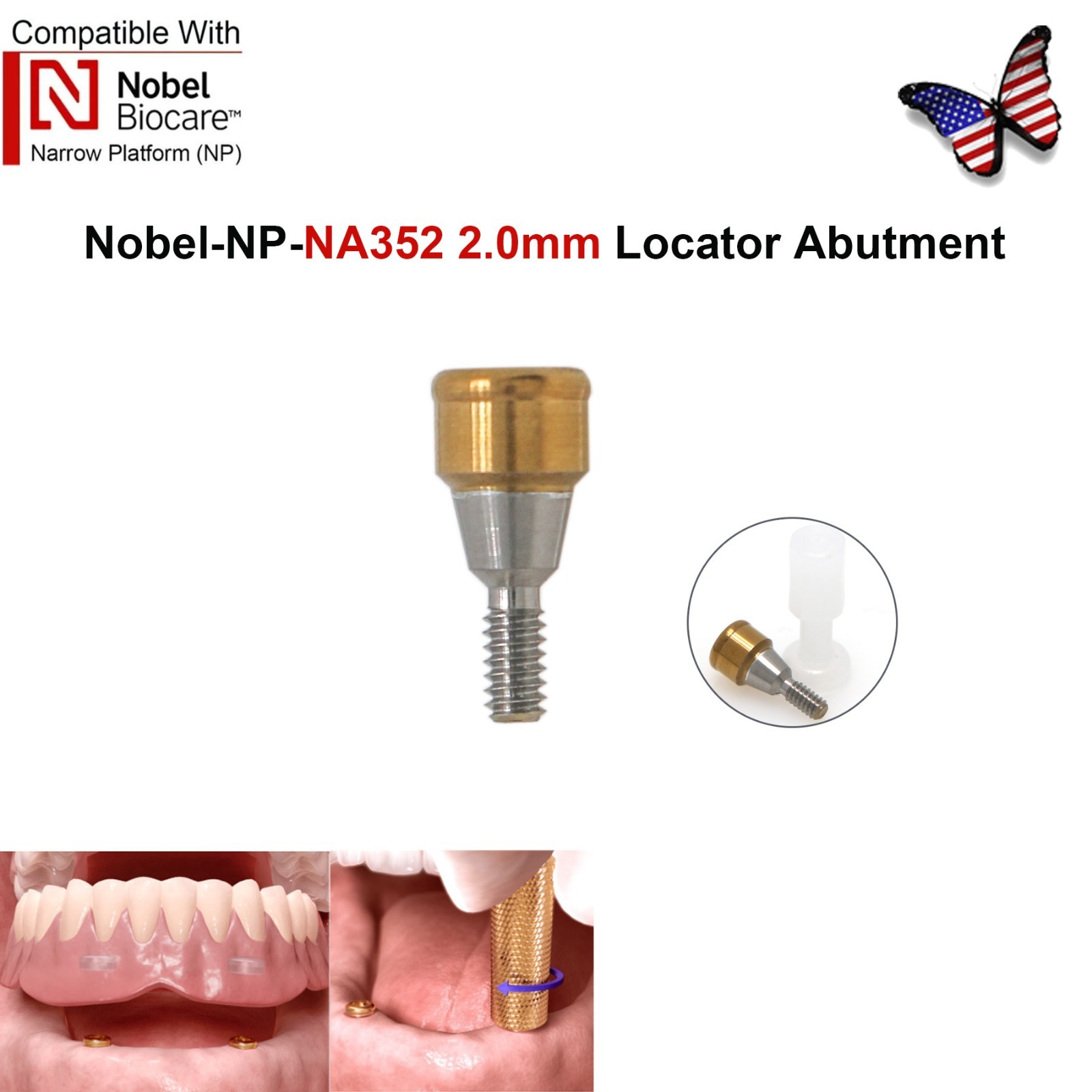 Dental Fit Zest Locator Abutment Legacy Anchor Overdenture Hiossen Zimmer Nobel