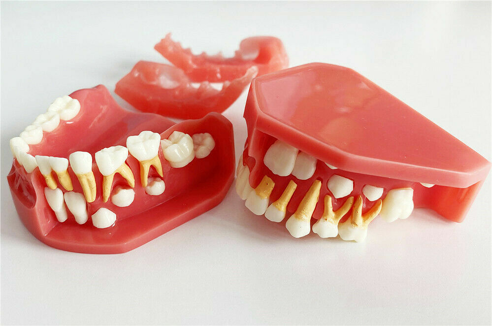 Dental Teaching Pediatrics Teeth Children 5-9Years Old Permanent Alternate Model