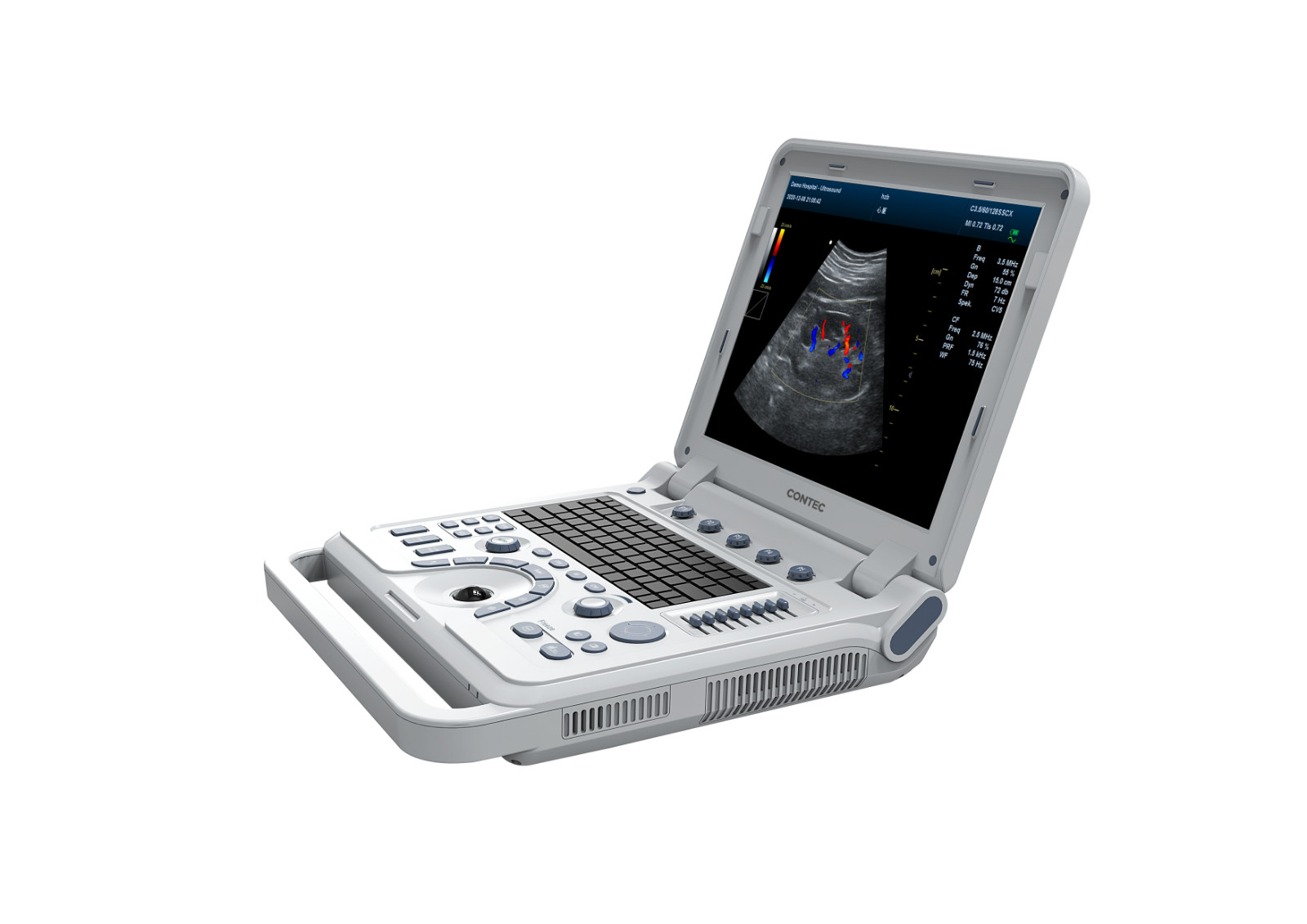 CMS1700A-VET Color Doppler 15″ Portable Laptop Convex Probe Animal Ultrasound