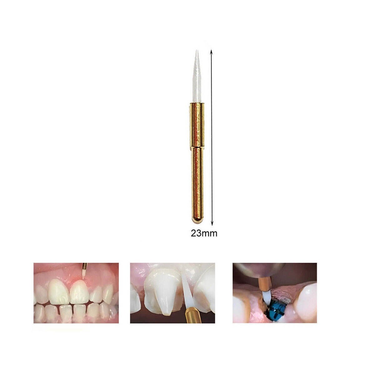 Dental Soft Tissue Trimmer Ceramic Bur Gingival Gingivectomy 21/23mm
