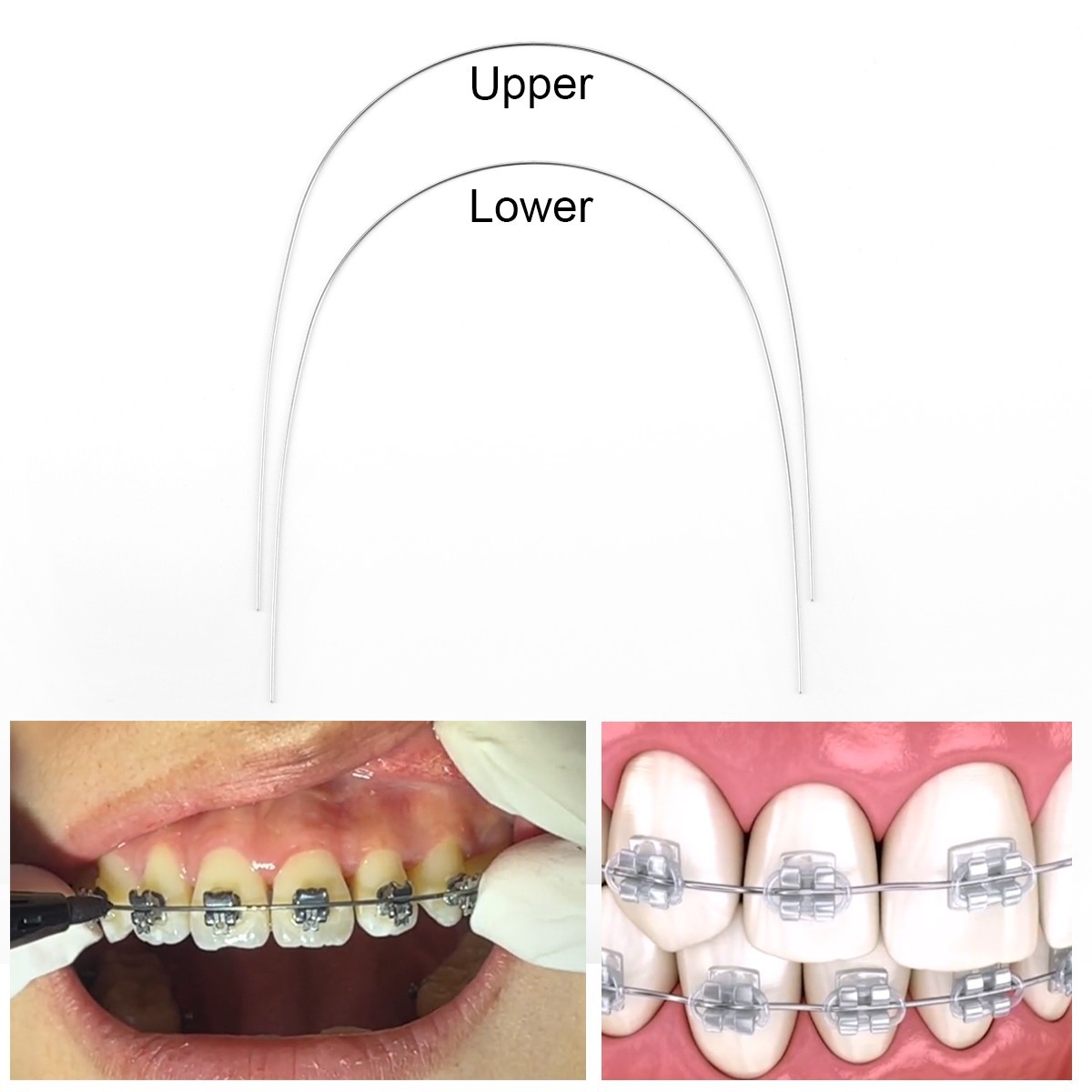 AZDENT Dental Orthodontic Round Arch Wire Oval Form Oval Round Stainless Steel