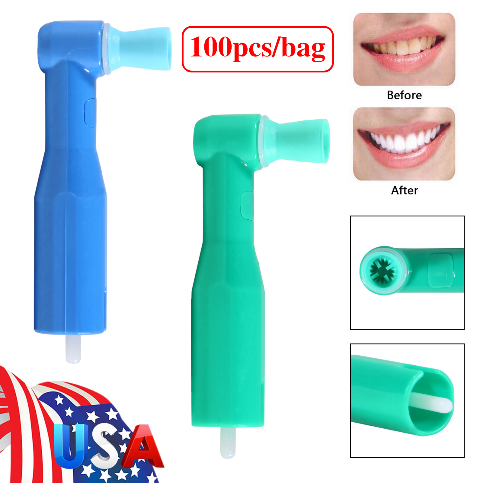 100-500* Dental Prophy Prophylaxis Angles Disposable Latex-Free Soft / Firm Cup