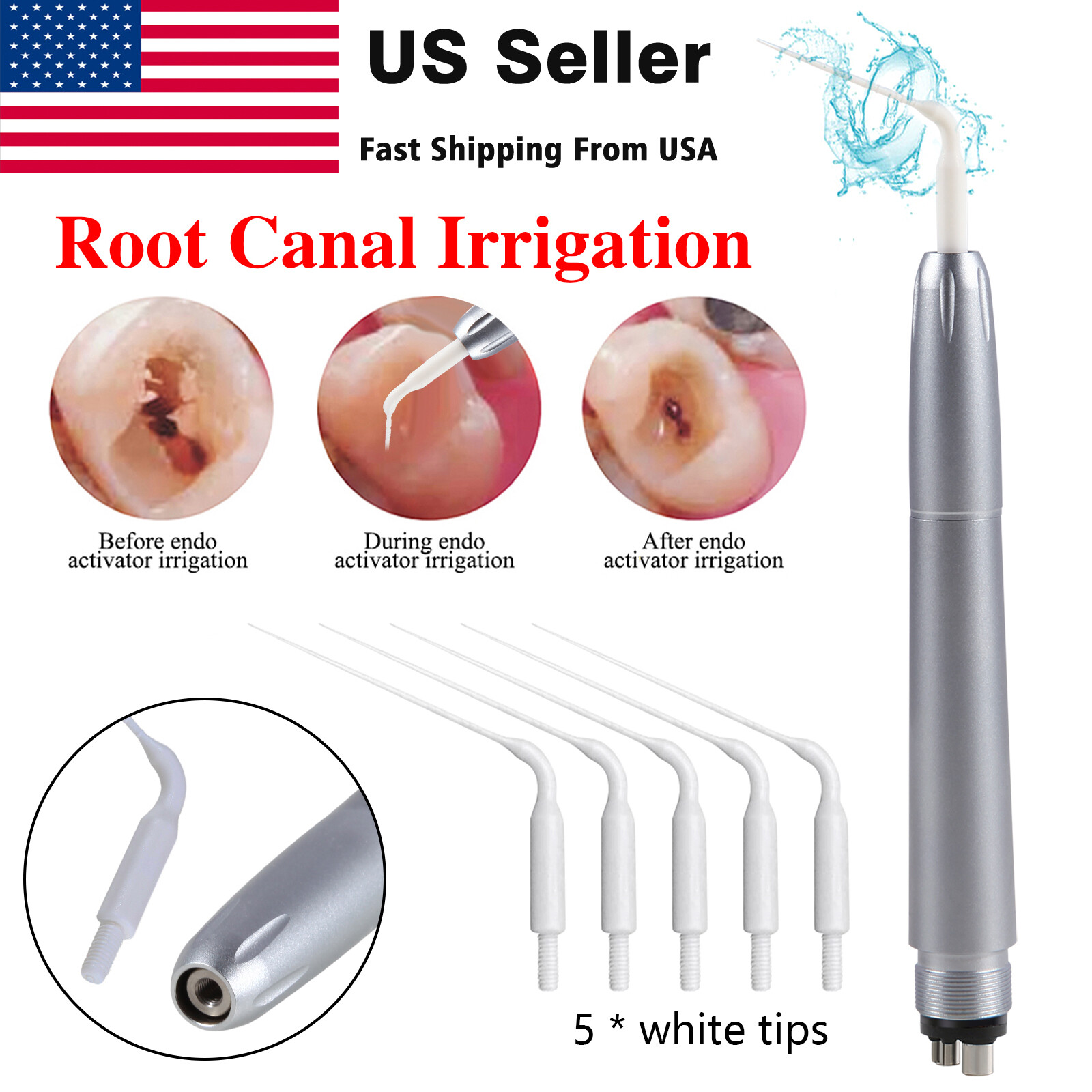 Dental Sonic Powered Endo Irrigator Tips EDDY Irrigation For Air Scaler Tip New