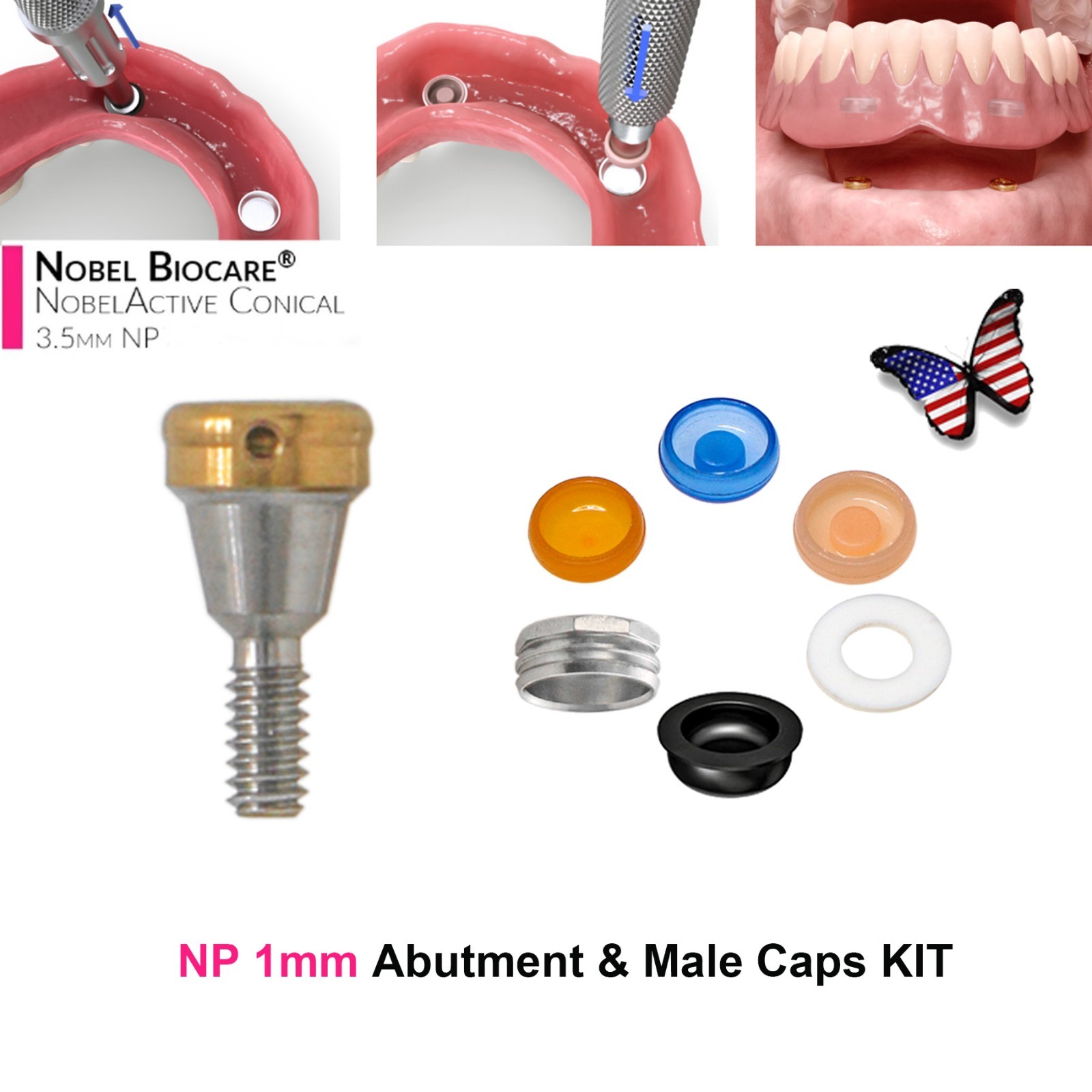 Dental Fit Zest Locator Abutment Legacy Anchor Overdenture Hiossen Zimmer Nobel