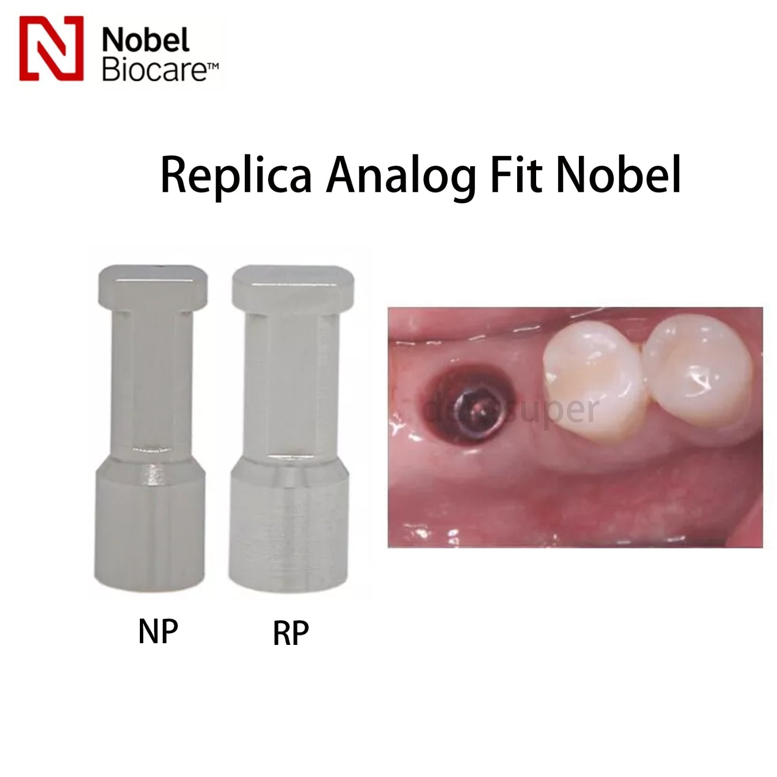 US Implant Fits Nobel Biocare Scan body/Analog NP/RP Digital compoentry CAD/CAM