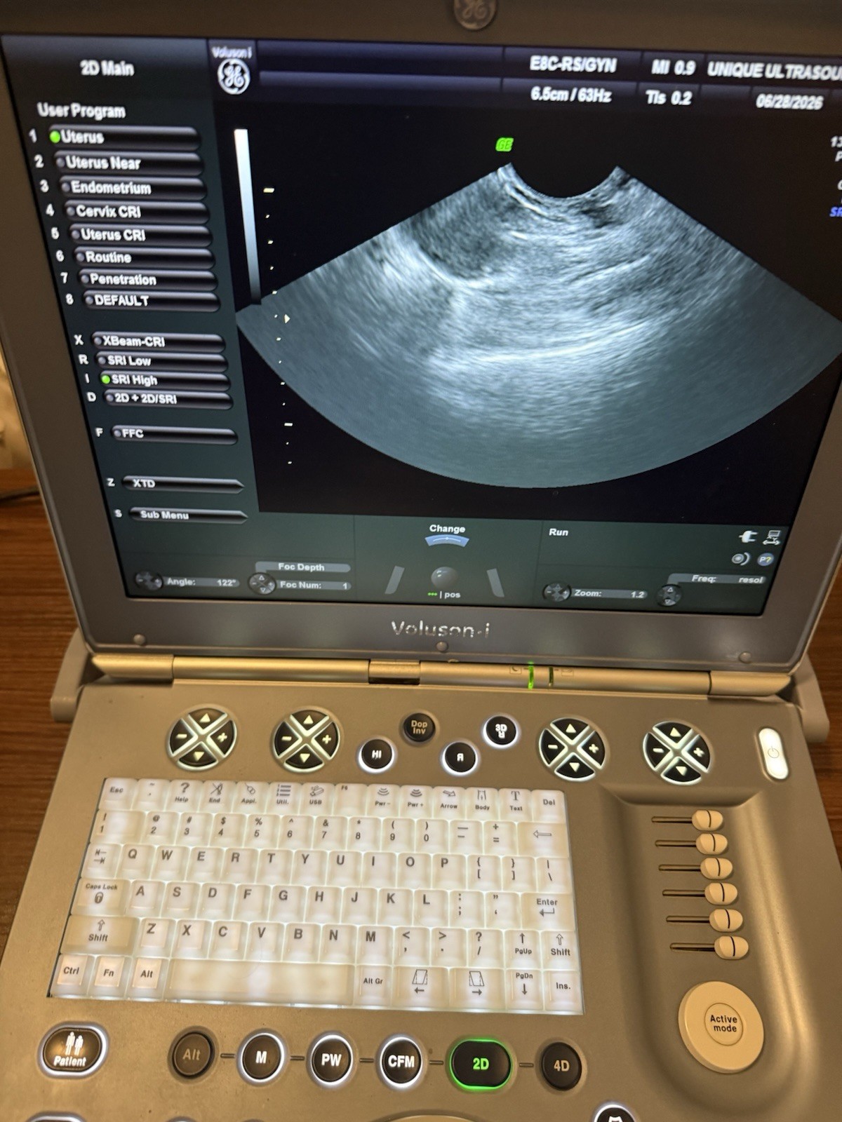 GE VOLUSON i BT14 2015 OB/GYN ULTRASOUND, BOX ONLY, PROBES ARE NOT INCLUDED.