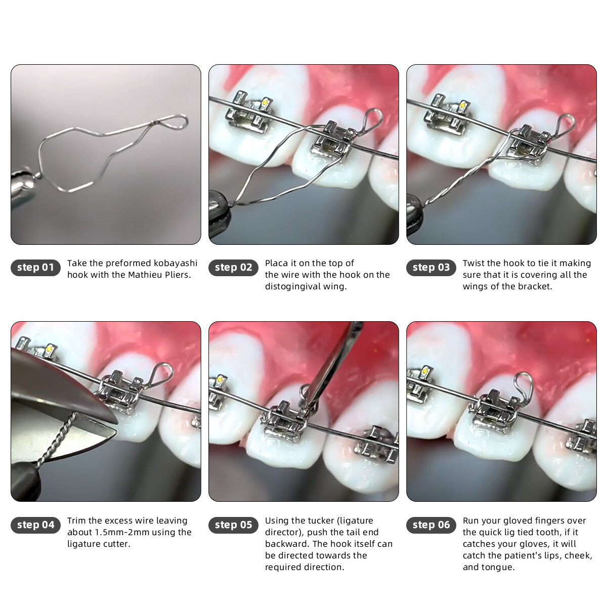 AZ Dental Orthodontic Ligature Wire SS Kobayashi Preformed Ties Long Short Twist